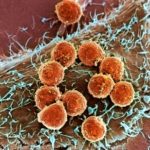 TUMORE AL PANCREAS, LA SPERANZA DA UN VACCINO SPERIMENTALE